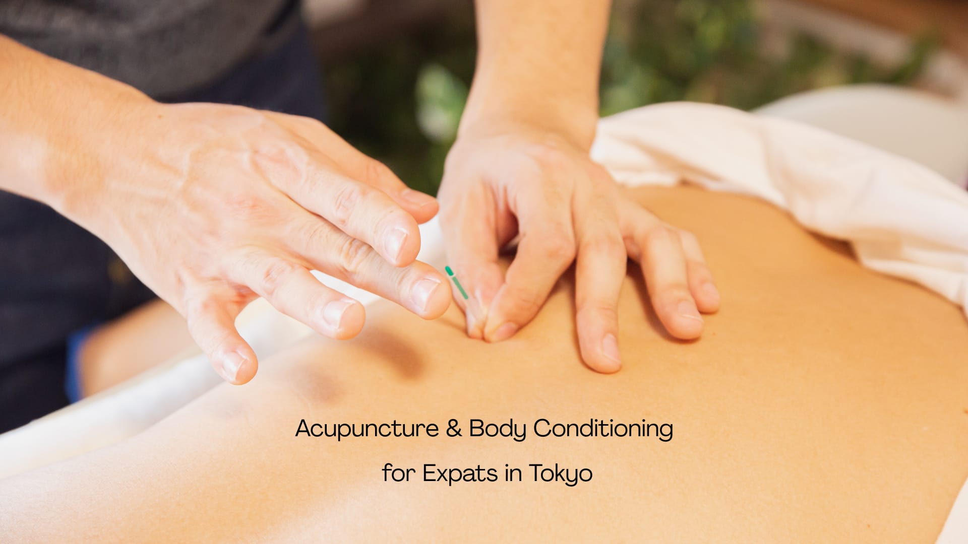 Read more about the article Why Acupuncture Is a Powerful Solution for Back Pain and Stiff Shoulders — For Expats Working in Tokyo